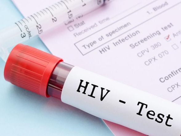 Aids, oltre 1.200 casi in Veneto