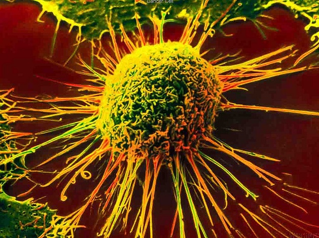 Tumori, scoperto motore molecolare che li alimenta