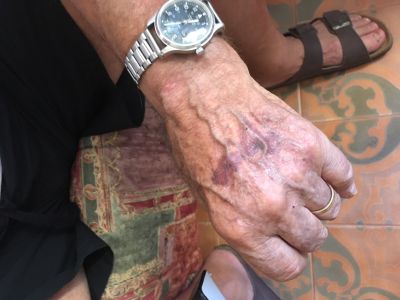 Mozzecane picchiati per strada da un motociclista