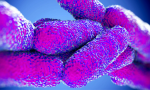 Disinfezione urgente per Legionella