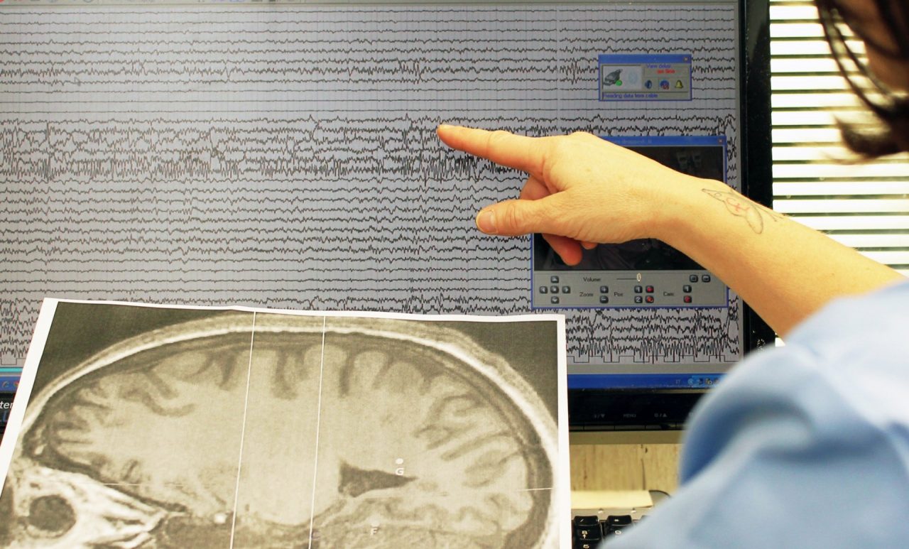 Epilessia, in una scuola su due si verifica un’emergenza