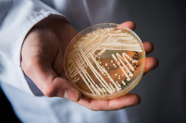 Candida auris: l’ultimo spauracchio del fungo che uccide in tre mesi