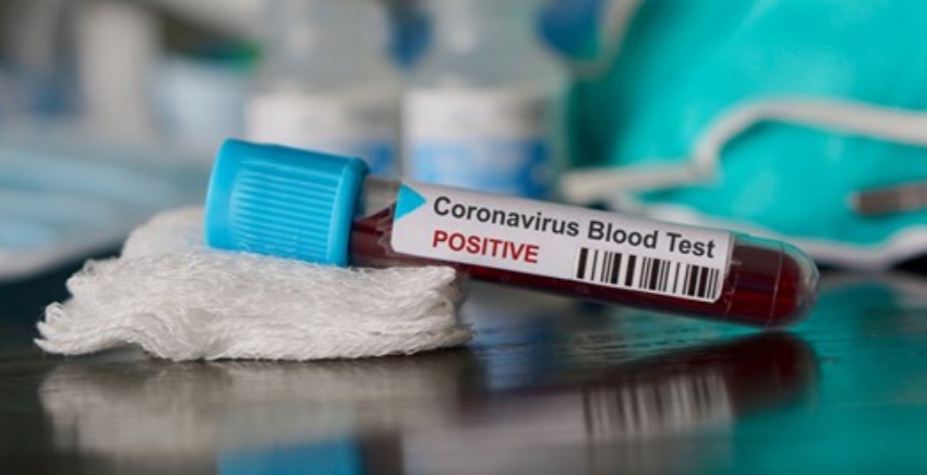 Coronavirus, una persona di Casaleone è risultata positiva al test