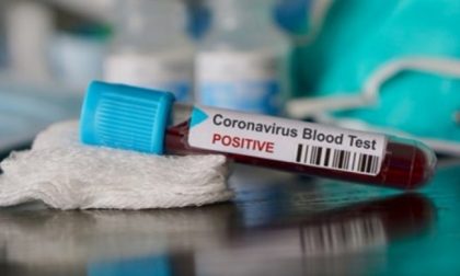 Primo test positivo del Coronavirus a Legnago