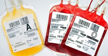 Terapia con l’uso del plasma dei guariti, primi miglioramenti sui pazienti Covid-19