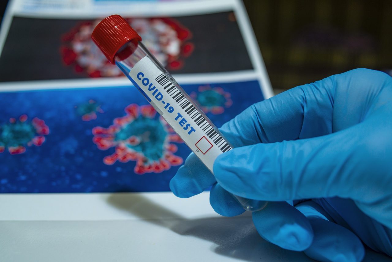 Registrati 112 nuovi casi di Coronavirus in provincia di Verona, i positivi superano quota mille