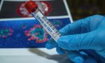 Registrati 112 nuovi casi di Coronavirus in provincia di Verona, i positivi superano quota mille
