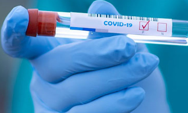 Avviata l’indagine sierologica nazionale, i cittadini selezionati dall’Istat saranno contattati dalla Croce Rossa
