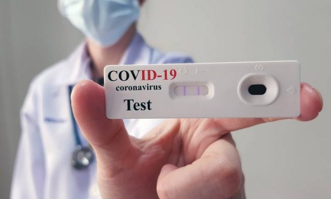 Test rapidi (anche a domicilio) a prezzi calmierati a partire dal 23 dicembre