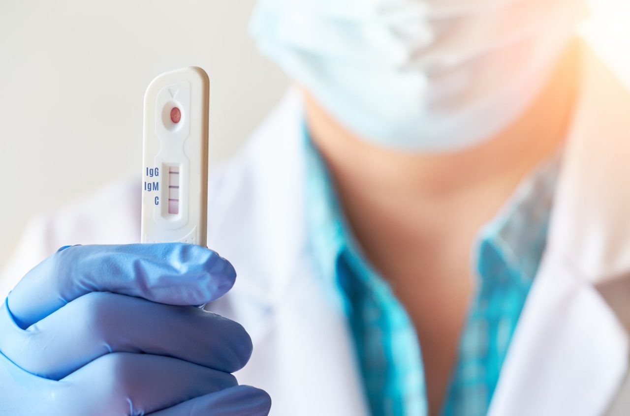 Tamponi rapidi: l’Ulss 9 ha distribuito i kit a tutti i medici di base
