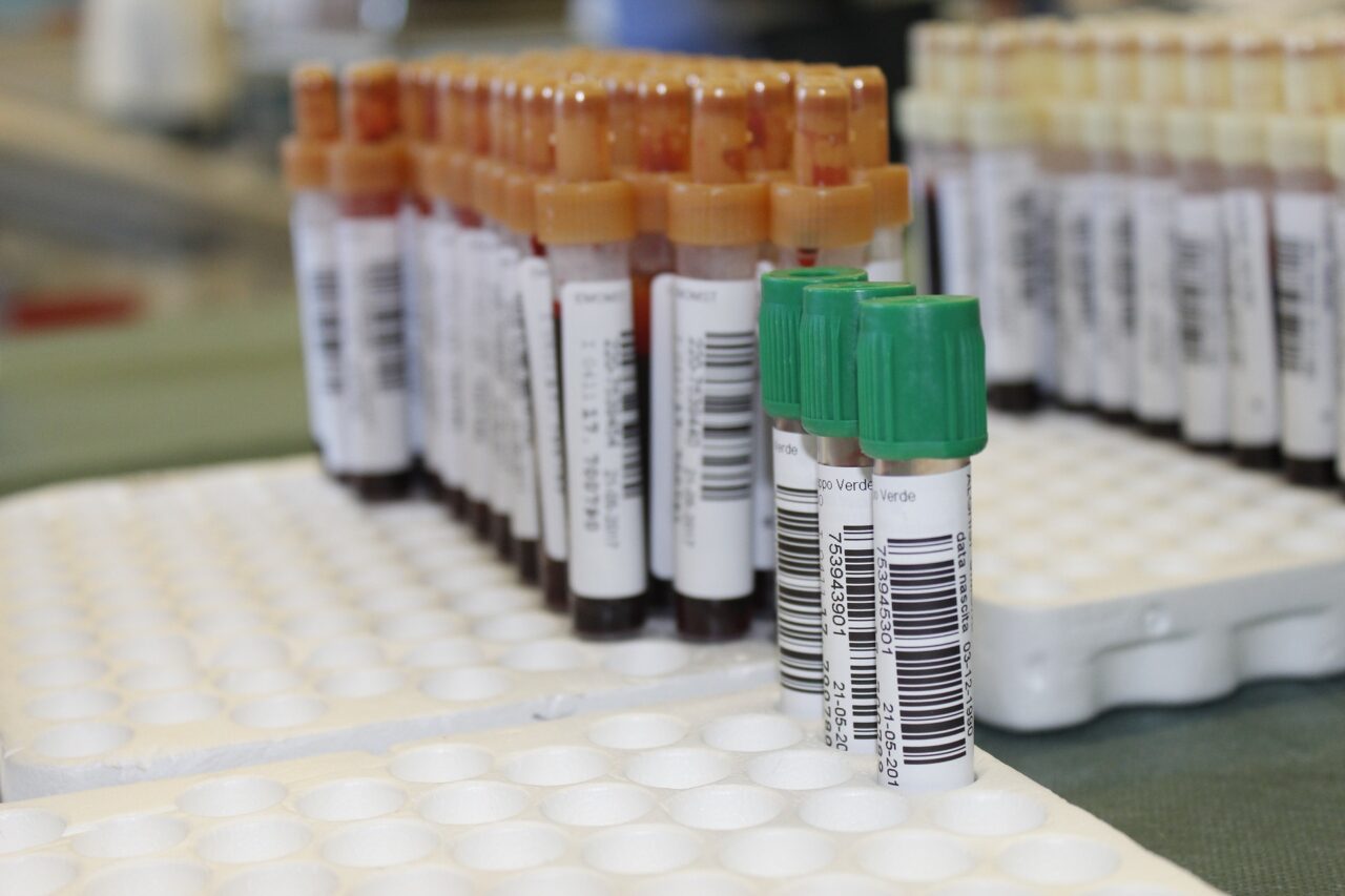 Bigon (PD): “Screening Pfas, nell’Ulss 9 i controlli sono ancora fermi”