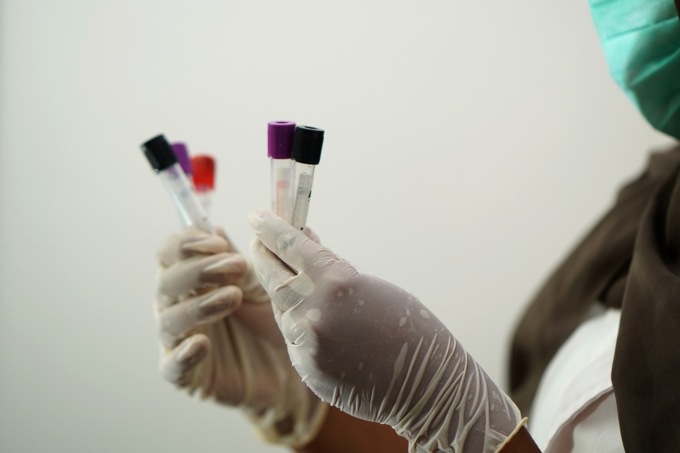 A Negrar isolato per la prima volta al mondo il virus Oropuche nel liquido seminale