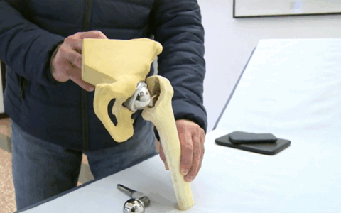 Nuove frontiere dell’ortopedia: a Negrar si punta sulla medicina rigenerativa