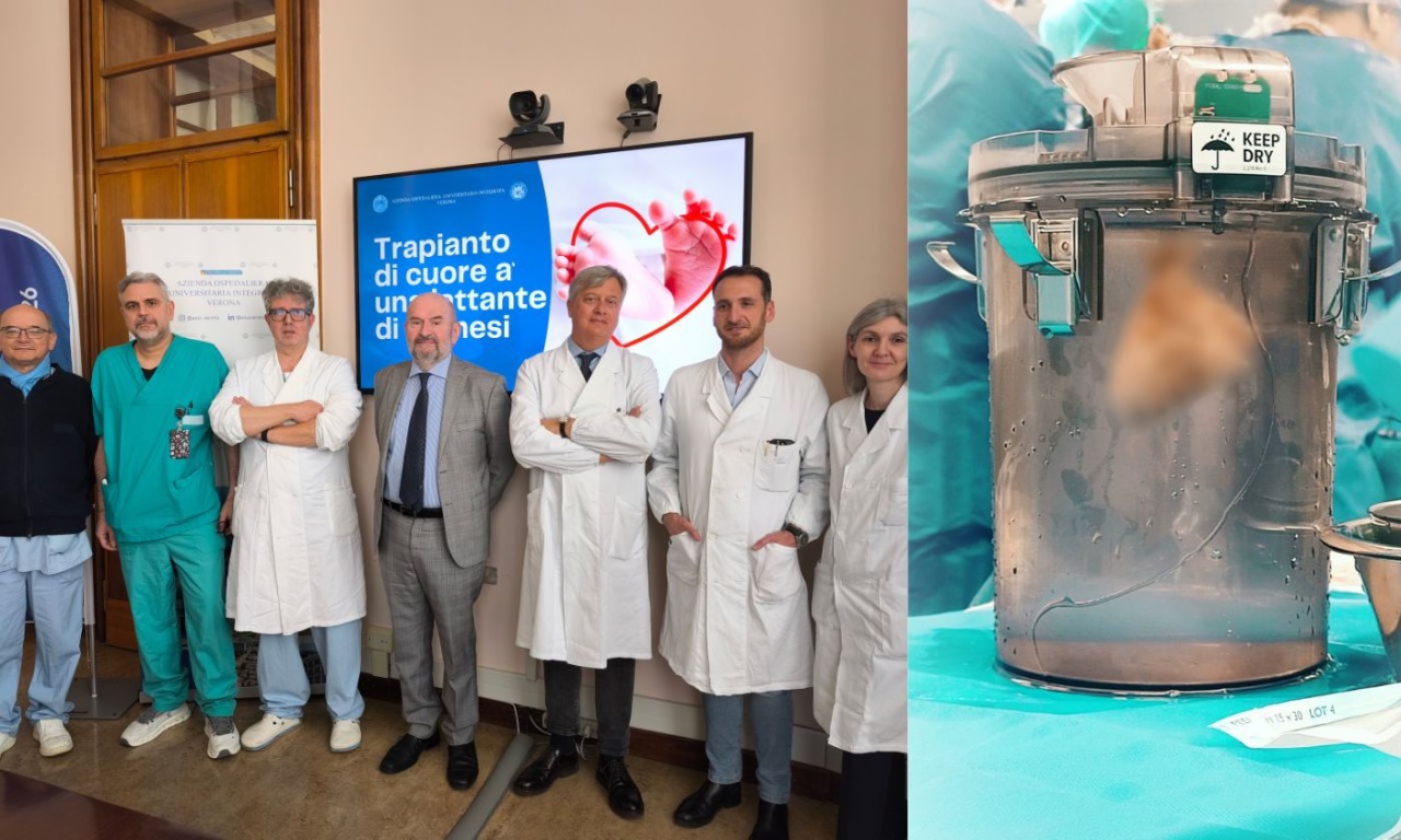 Bimba di 11 mesi salvata a Verona da una grave cardiomiopatia con un trapianto di cuore