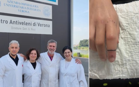 Il caldo anomalo fa “svegliare” in anticipo le vipere: bimba di 10 anni morsa in Lessinia